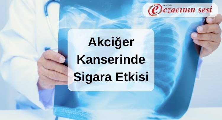  Akciğer Kanserinde Sigara Etkisi